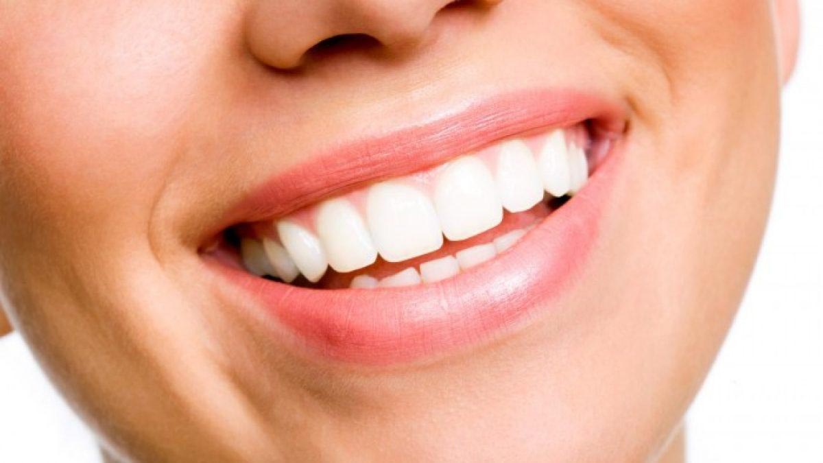 donna con denti bianchi